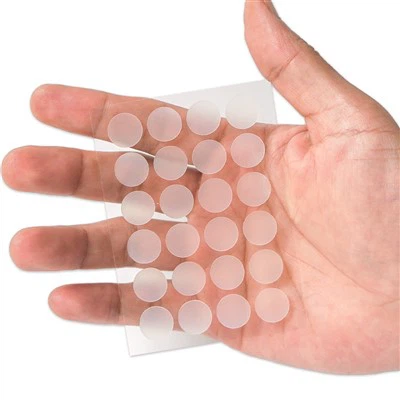 Paistí acne cruth cruinn hidreacóideach